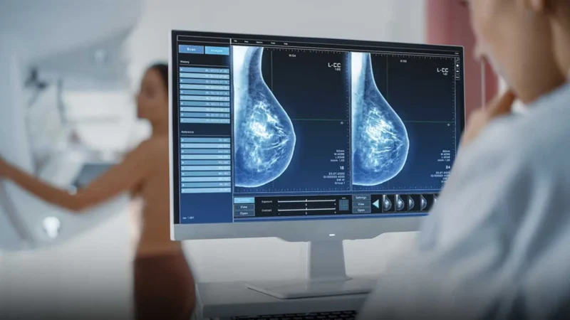 IA contra el cáncer de mama en tres frentes de atención